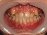 無料カウンセリング