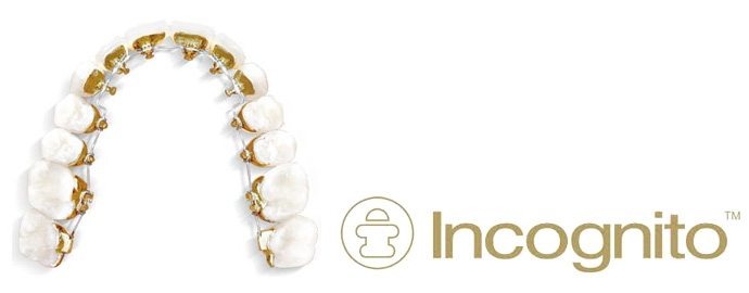 インコグニート