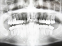 矯正治療の流れ