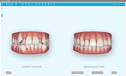 アウトカムシュミレーション結果