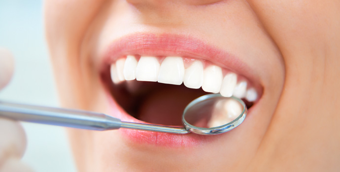 ホワイトニング