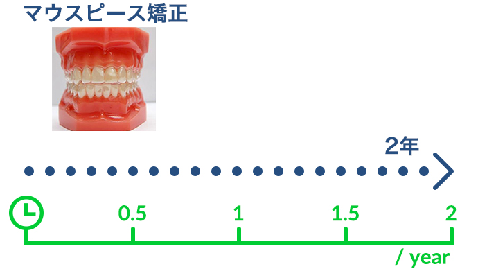 マウスピースによる矯正治療の流れ